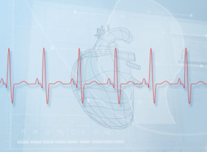 Bradycardia errors New Jersey