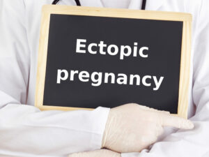 Undiagnosed Ectopic Pregnancy Lawsuit Help NJ