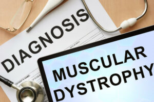 File a Lawsuit for Muscular Dystrophy Malpractice in NJ