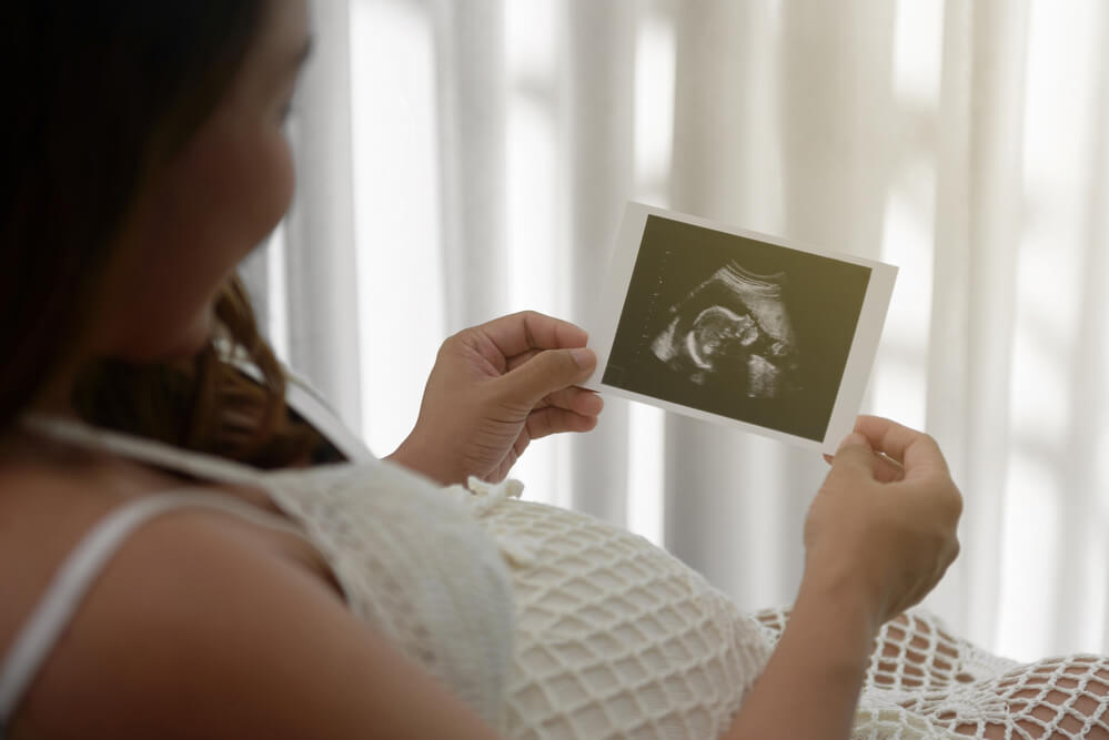 Breech Baby Complications Attorney NJ