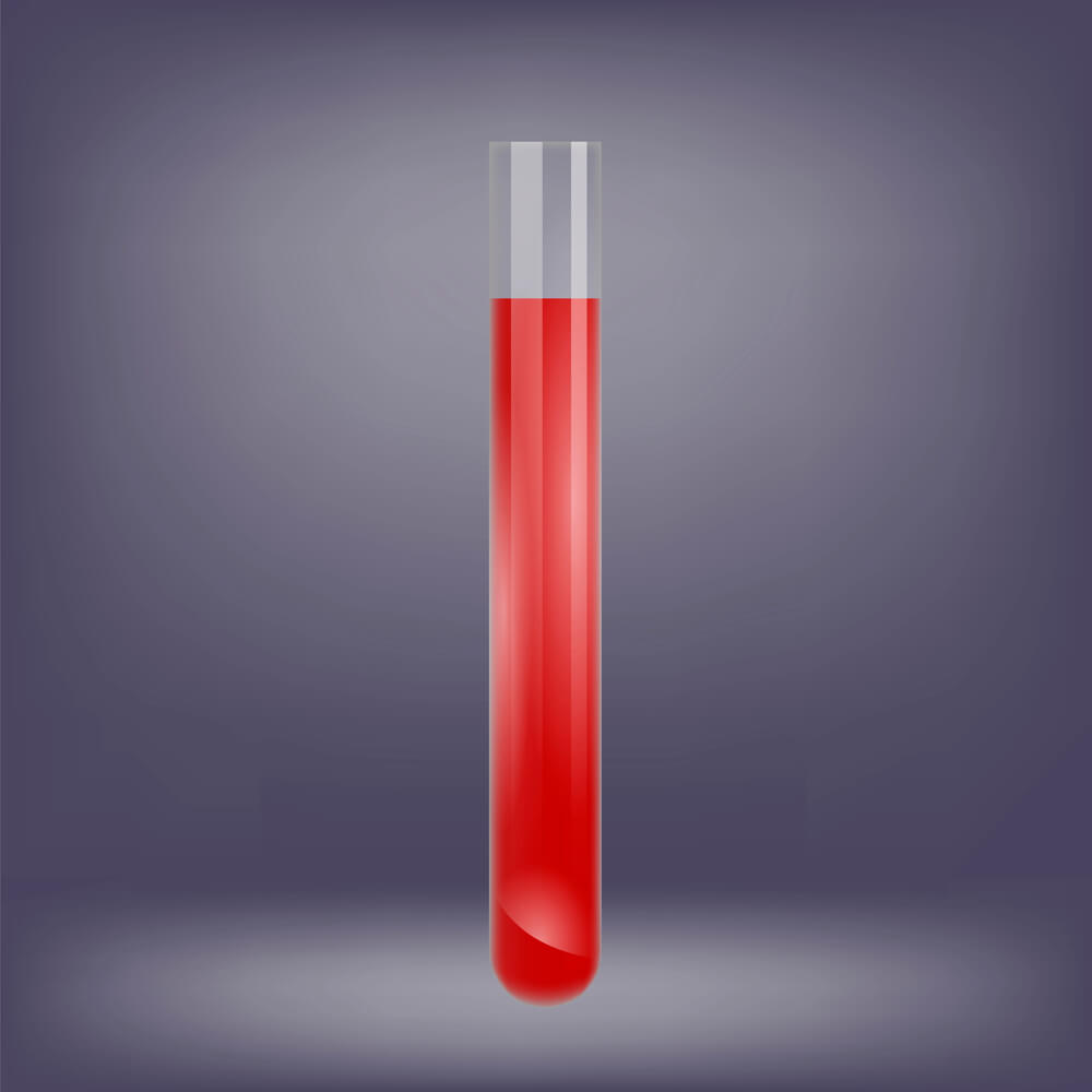 Probative Value of Blood Gas Tests after Birth