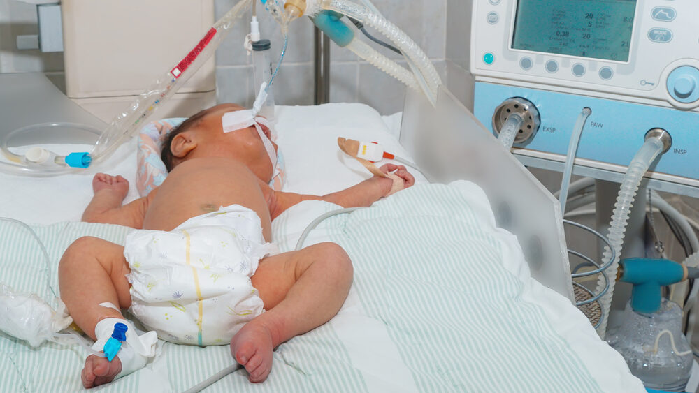 Silent Hypoxia Birth Injuries: When a Baby’s Oxygen Loss Goes Undetected